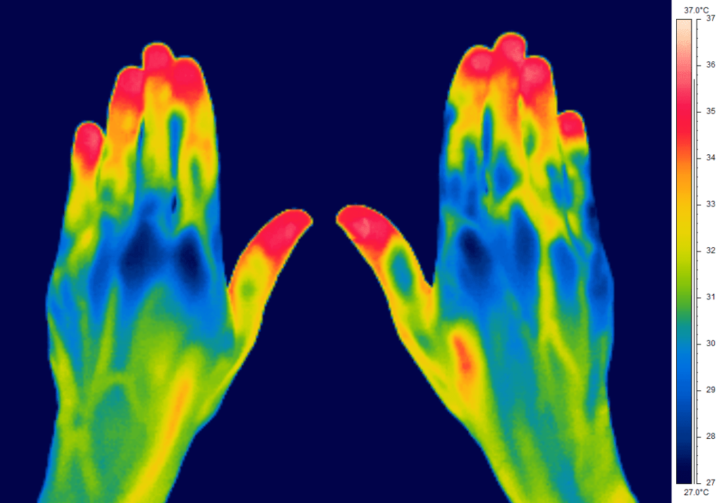 Thermal camera image showing infrared radiation from hands